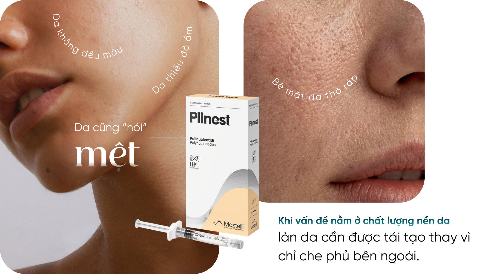 Plinest 01